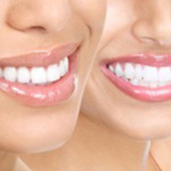 Ästhetische Zahnheilkunde | Zahnarzt Köln PAN Klinik